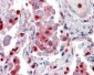 Goat Anti-S100A9 Antibody